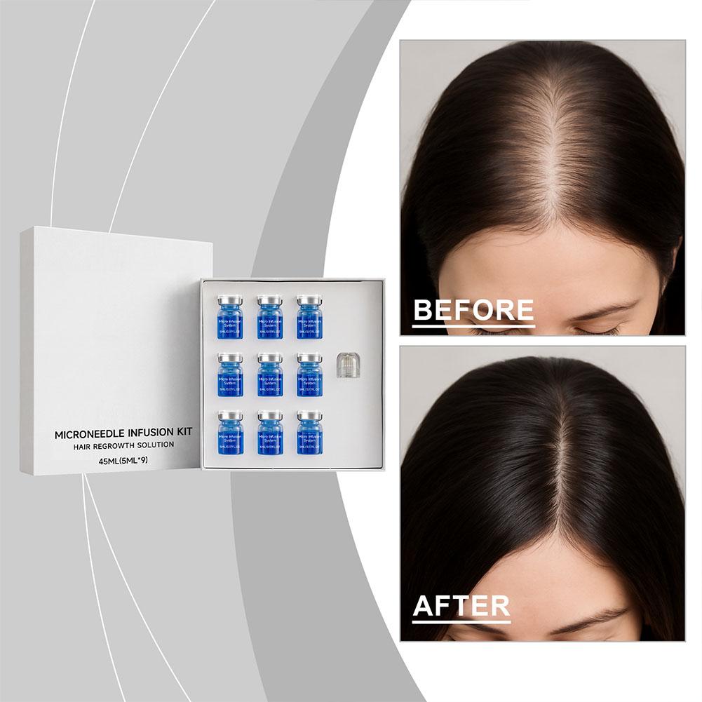 Hair Care Routine - 0.25mm Haar Essentiële Serum Micro-naald Roller