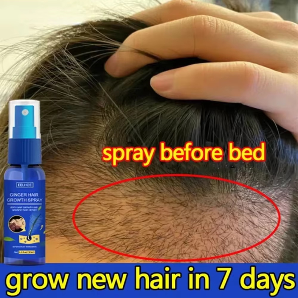 Hair Care Products - Snelle gember haar groeispray, wortelversterkend, tegen