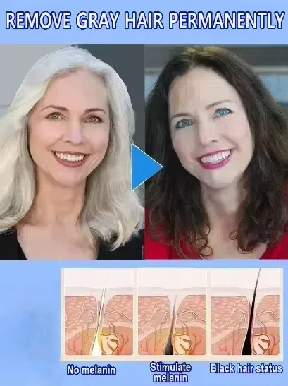 Witte haarmoordenaar, verwijde - Hair Care Natural Products recensie en prijs