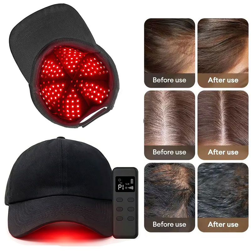 660nm 940nm Licht 142 Groepen/ - Hair Care Wella recensie en prijs