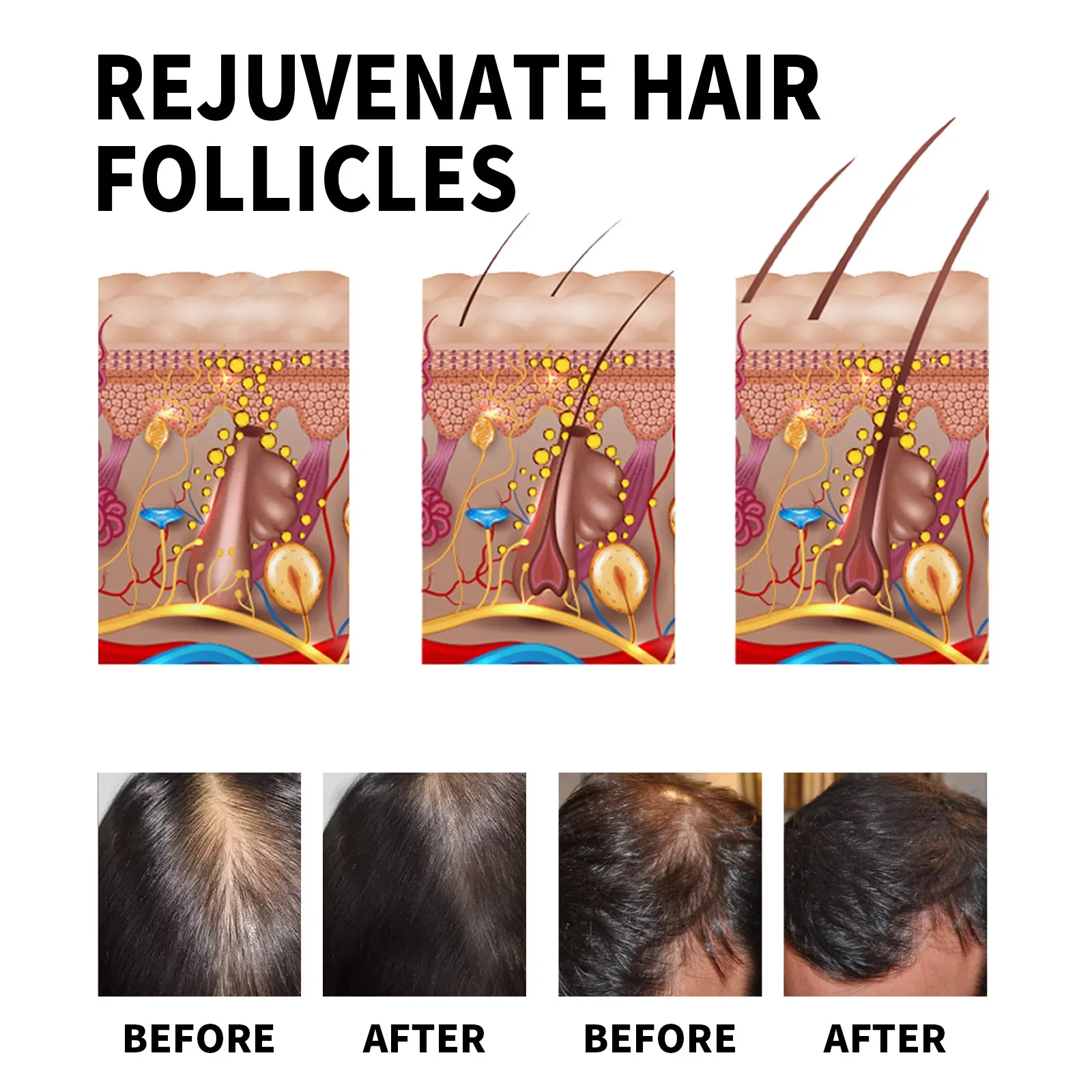 Gember Haargroei Producten Sne - Hair Care For Dry And Frizzy Hair recensie en prijs