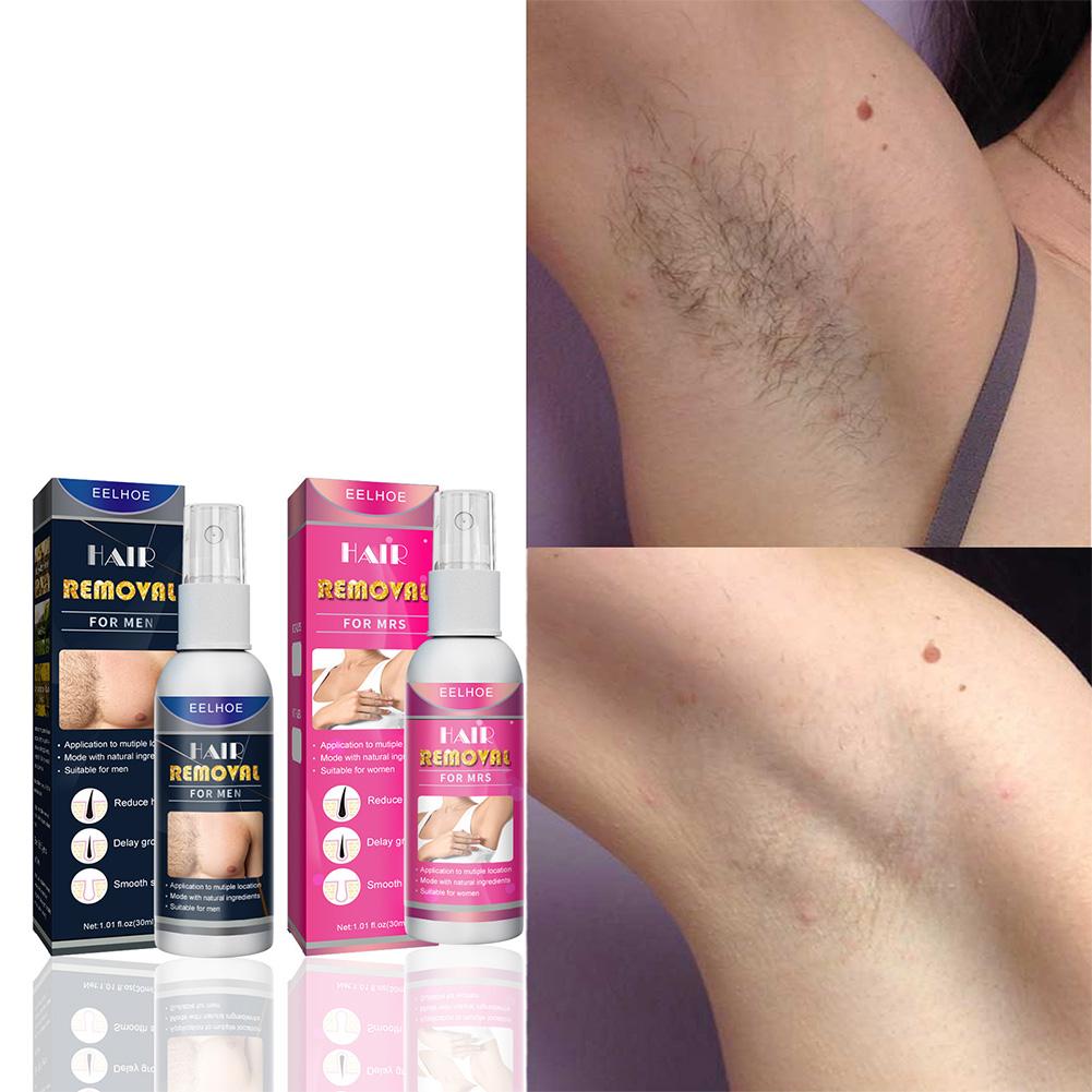 1/2 STUKS Super Natuurlijke Pi - Hair Care China recensie en prijs