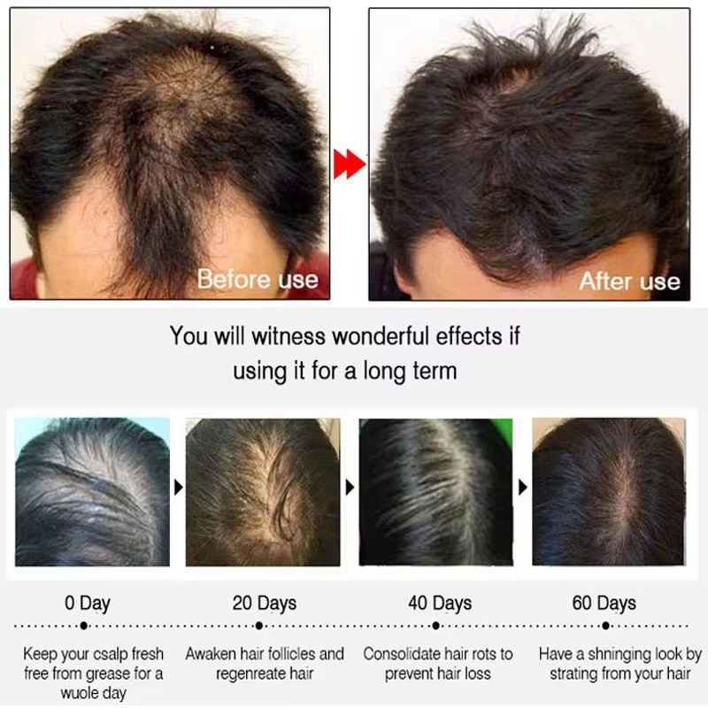 Snelle gember haar groeispray, - Hair Care Products recensie en prijs